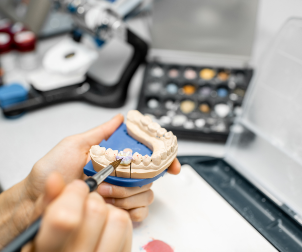 prothèse dentaire, Modélisation 3D dentaire